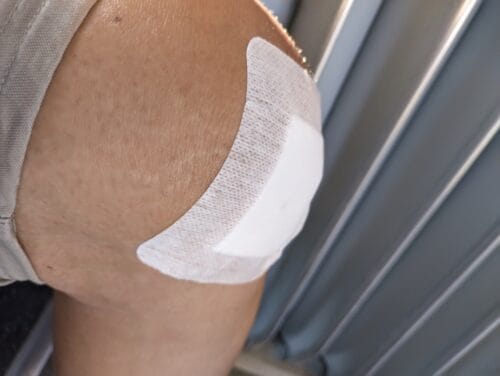 Kolano z naklejonym sporym kwadratowym plastrem.